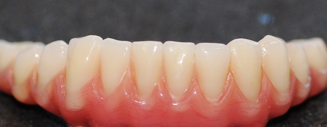 Russell Klein Ultra Thin Dentures Laurel MD 20723